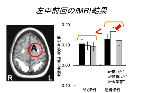 Figure 1: The left middle frontal gyrus is the part in the red circle. In the graph on the right, the right-hand side indicates cases where the subjects imagined the words at the learning stage, and the left-hand side indicates cases where they heard the words. The bars show what they answered: “heard” in black, “imagined” in white, and “neither” in gray. The vertical axis indicates the average change ratio of blood flow in the brain.