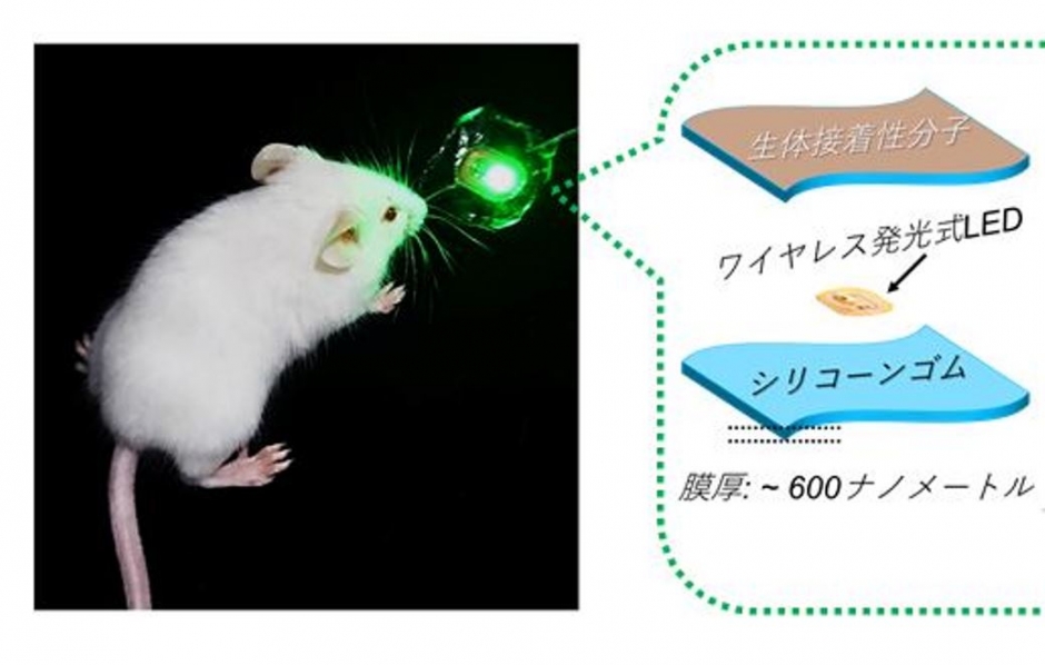 シールのように貼れる無線給電式発光デバイスを用いた光がん治療システム