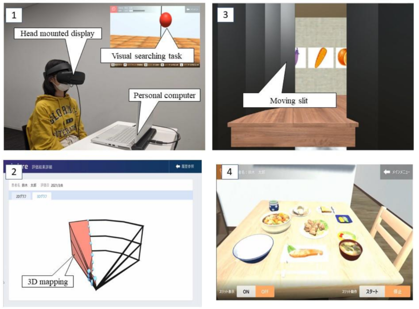半側空間無視を 3 次元的に検出・個別介入できる VR 型システムを実用化－視空間認知障害の３次元的な病態解釈の実現に一歩前進－