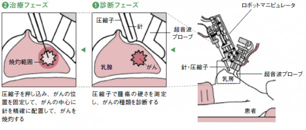 う