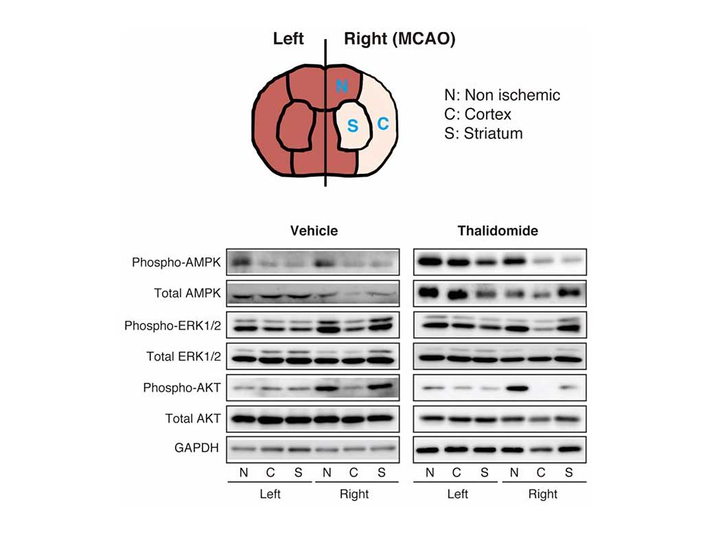 How thalidomide is effective against cerebral infarction