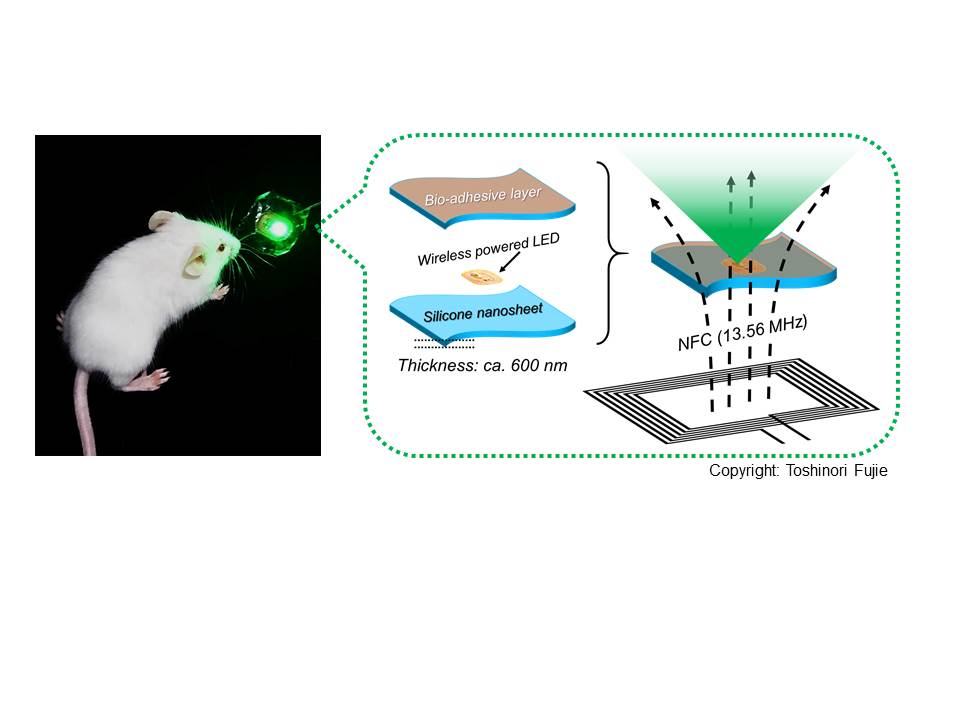 Bioadhesive, wirelessly-powered implant emitting light to kill cancer cells