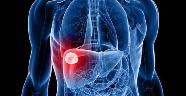 Study raises hopes for development of new treatment for chronic liver ...