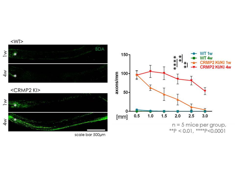 Inhibition of protein phosphorylation promotes optic nerve regeneration after injury